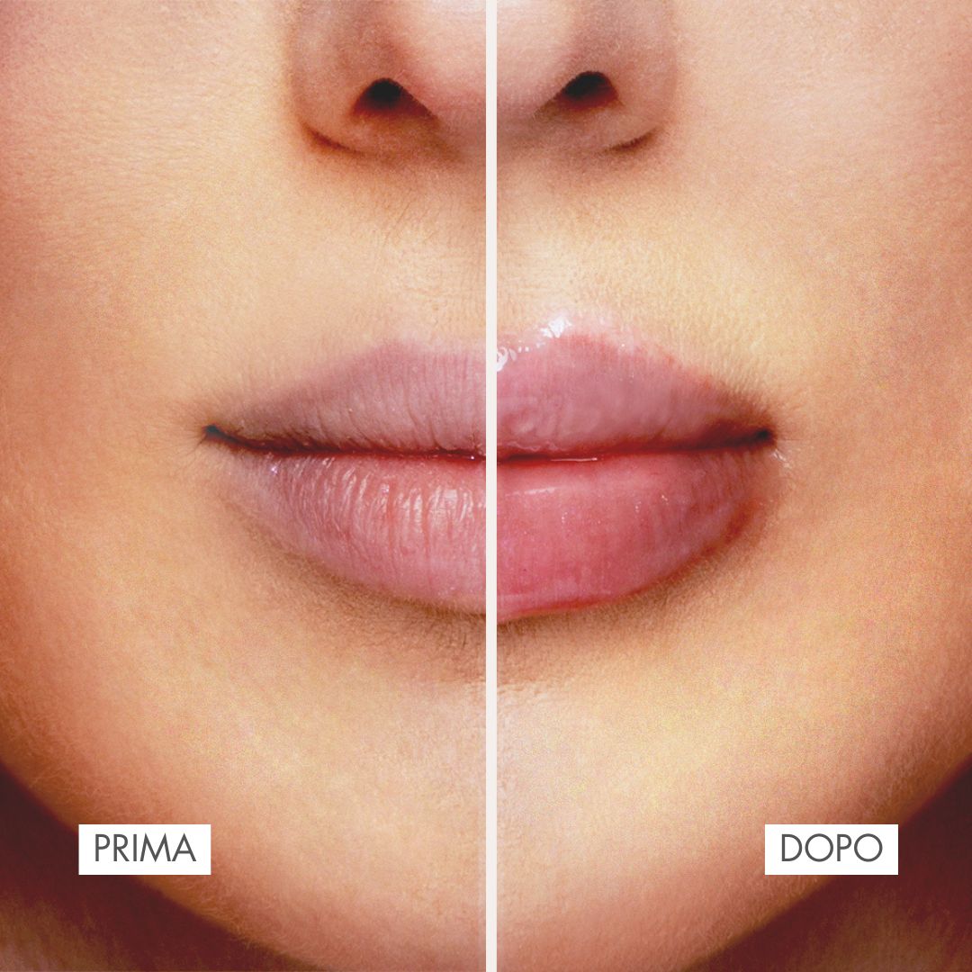 EMOTION LIP PLUMPER | LIP PLUMPER BALM