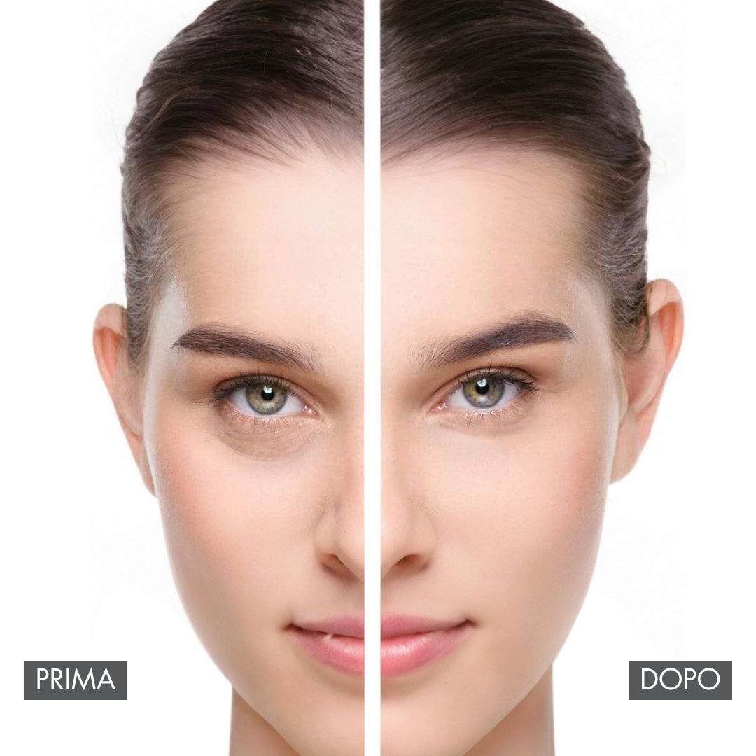 SOYSOY EYE CONTOUR FOR BAGS AND DARK CIRCLES